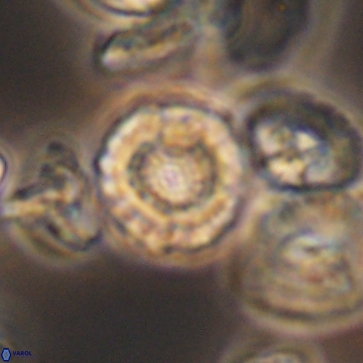 Cribrocorona gallica 12171