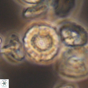 Cribrocorona gallica 12171
