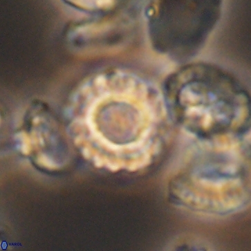 Cribrocorona gallica 12172