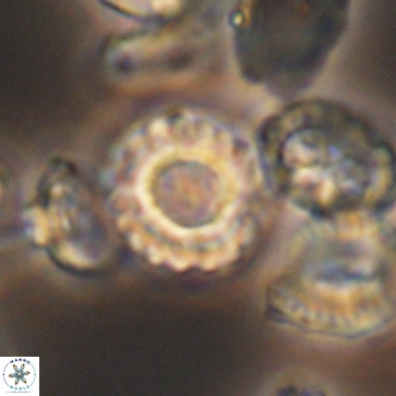 Cribrocorona gallica 12172