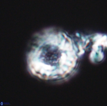 Cribrocorona gallica 12303