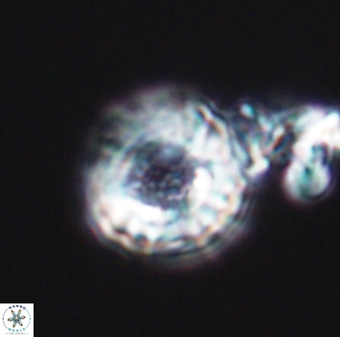 Cribrocorona gallica 12303