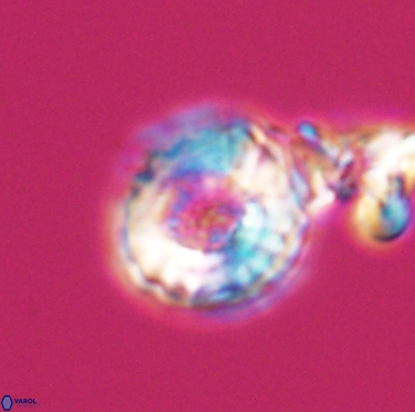 Cribrocorona gallica 12304