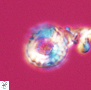 Cribrocorona gallica 12304