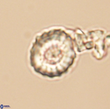 Cribrocorona gallica 12305