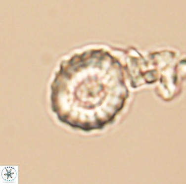 Cribrocorona gallica 12305