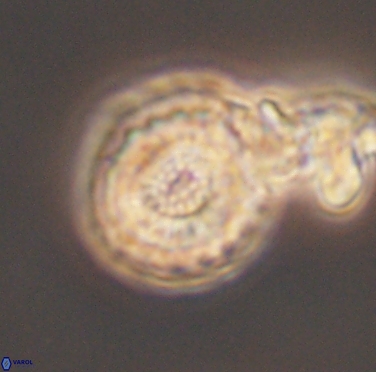 Cribrocorona gallica 12306