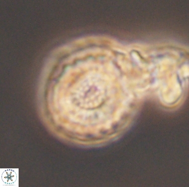 Cribrocorona gallica 12306