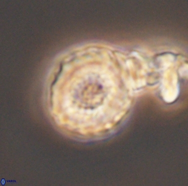 Cribrocorona gallica 12307