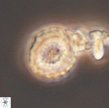 Cribrocorona gallica 12307