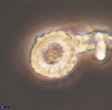 Cribrocorona gallica 12308