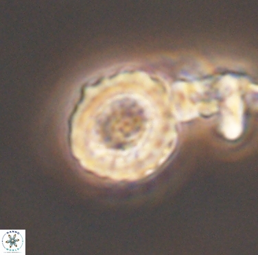 Cribrocorona gallica 12308