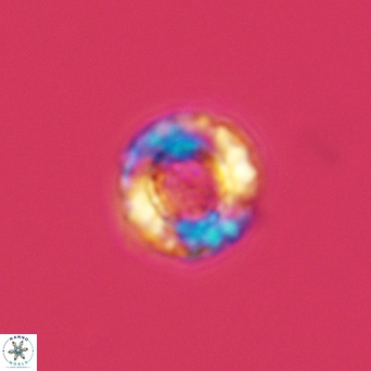 Cribrocorona gallica 2999