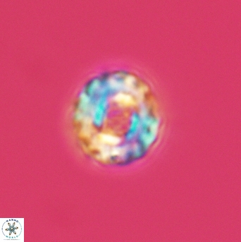 Cribrocorona gallica 3008
