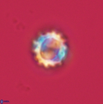 Cribrocorona gallica 3009