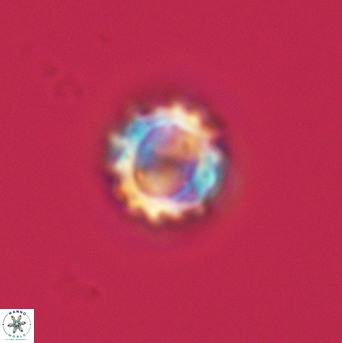 Cribrocorona gallica 3009