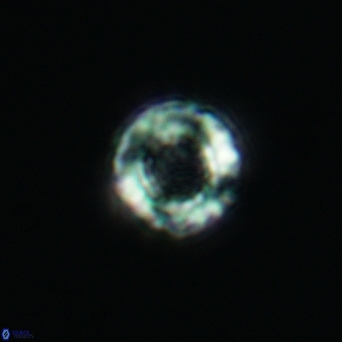 Cribrocorona gallica 3000