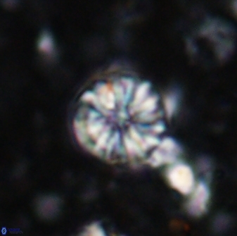 Cribrocorona echinus 13859