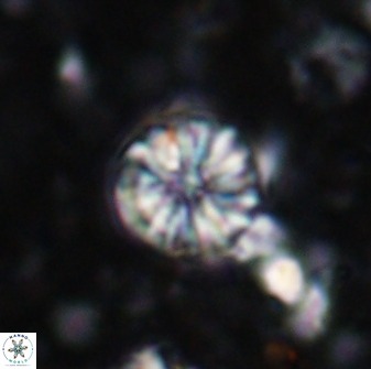 Cribrocorona echinus 13859