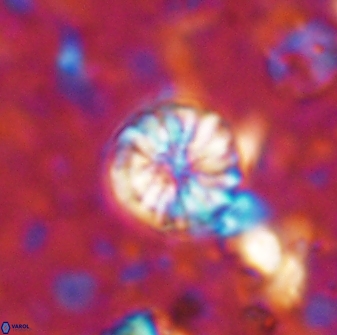 Cribrocorona echinus 13860