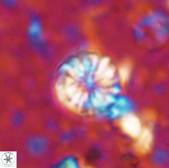 Cribrocorona echinus 13860