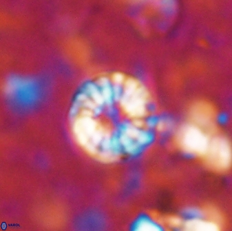 Cribrocorona echinus 13861