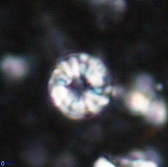 Cribrocorona echinus 13862