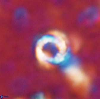 Cribrocorona echinus 13867