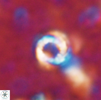 Cribrocorona echinus 13867
