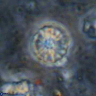 Cribrocorona echinus 13868