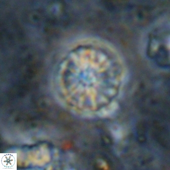 Cribrocorona echinus 13868