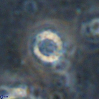 Cribrocorona echinus 13869