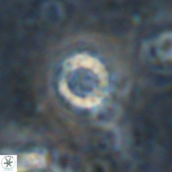 Cribrocorona echinus 13869