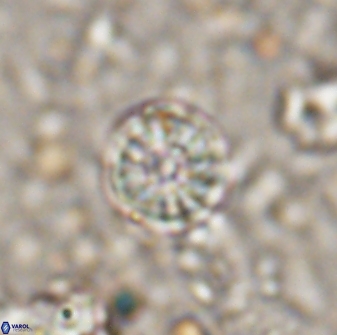 Cribrocorona echinus 13870