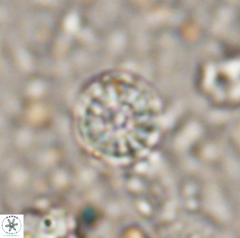 Cribrocorona echinus 13870