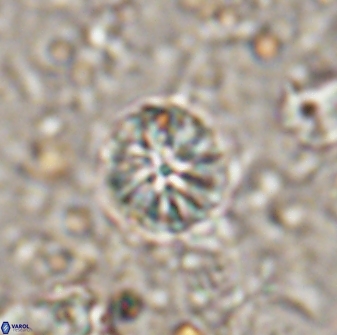 Cribrocorona echinus 13872