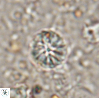 Cribrocorona echinus 13872