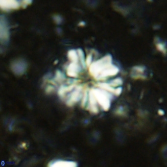 Cribrocorona echinus VR 11411