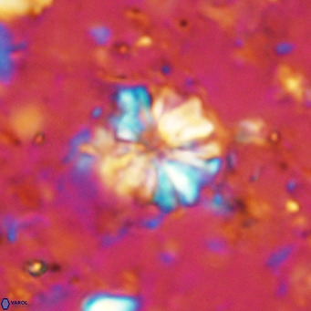 Cribrocorona echinus VR 11412