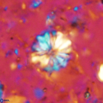 Cribrocorona echinus VR 11416