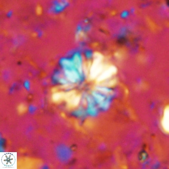 Cribrocorona echinus VR 11416