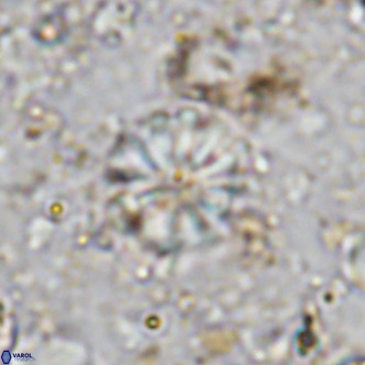 Cribrocorona echinus VR 11417