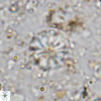 Cribrocorona echinus VR 11417