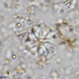 Cribrocorona echinus VR 11418