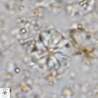 Cribrocorona echinus VR 11418