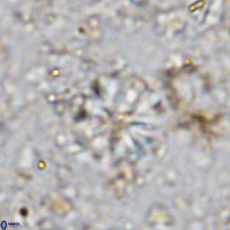 Cribrocorona echinus VR 11419
