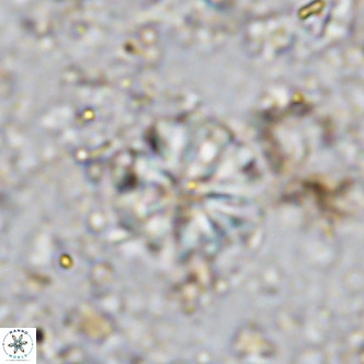 Cribrocorona echinus VR 11419
