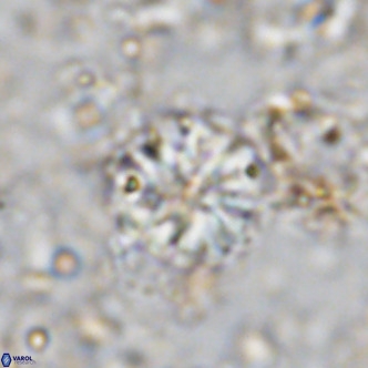 Cribrocorona echinus VR 11420
