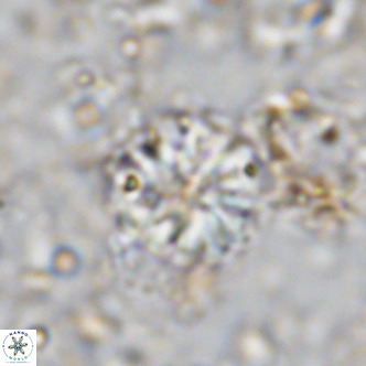 Cribrocorona echinus VR 11420