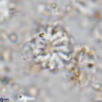 Cribrocorona echinus VR 11422